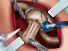 ניתוח ירך אלה